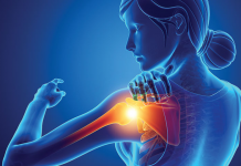 İnferior Omuz Çıkığı (Luksasyo Erekta)