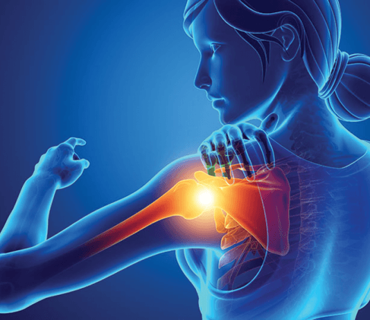 İnferior Omuz Çıkığı (Luksasyo Erekta)