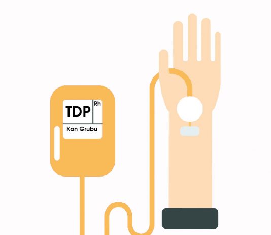 Taze Donmuş Plazma (TDP) Uygulama