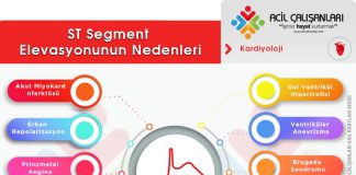 ST Elevasyonu Yapan Nedenler Akıl Kartı