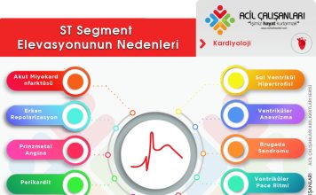 ST Elevasyonu Yapan Nedenler Akıl Kartı