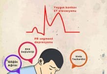 Perikardit Acil Yaklaşım