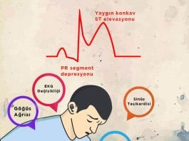 Perikardit Acil Yaklaşım