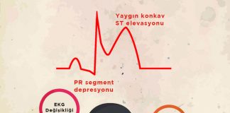 Perikardit Acil Yaklaşım