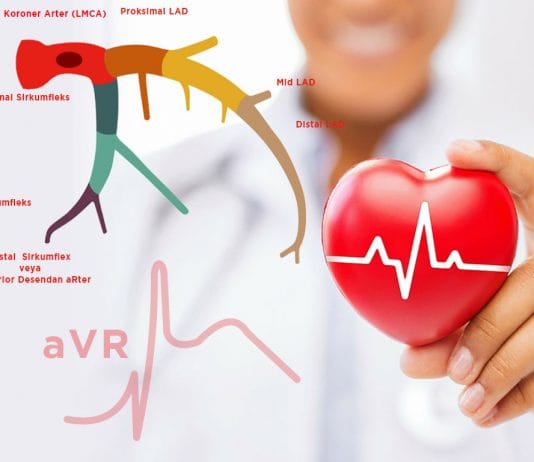 Sol Ana Koroner Arter (LMCA) Tıkanıklığı