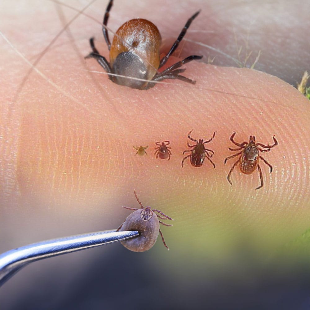 Kene Isırmaları Acil Yaklaşım | Acil Çalışanları