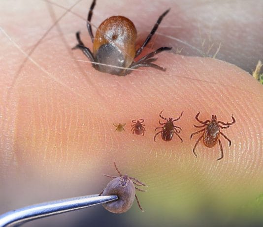 Kene Isırmaları Acil Yaklaşım