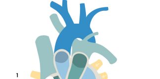 Sol Dal Bloğu (LBBB)