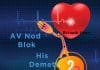 2. Derece Atriyoventriküler (AV) Blok , Mobitz Tip 2