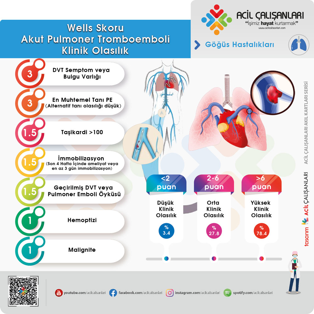 Wells Skoru Akut Pulmoner Emboli