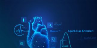 Sgarbossa Kriterleri Sol Dal Bloğu – Miyokard İnfarktüsü Tanısı