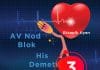 3. Derece Atriyoventriküler (AV) Blok (Tam Kalp Bloğu)