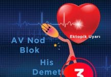 3. Derece Atriyoventriküler (AV) Blok (Tam Kalp Bloğu)