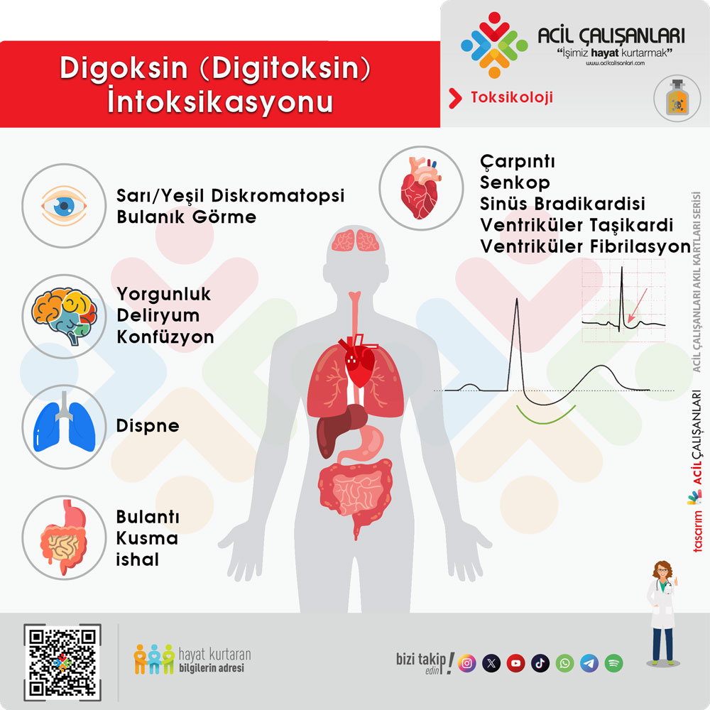 Digoksin Toksisitesi Klinik Bulgular