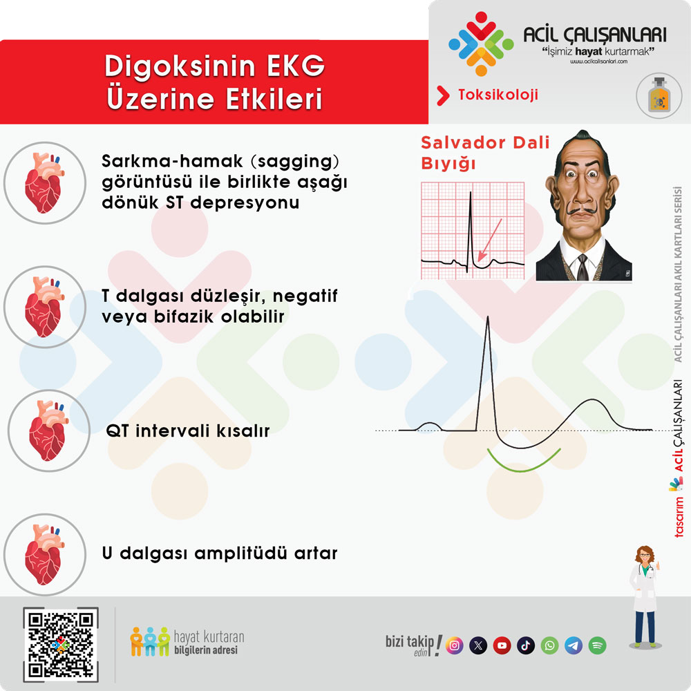 Digoksinin EKG Üzerine Etkisi