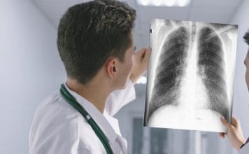 Akciğer Grafisi Değerlendirme