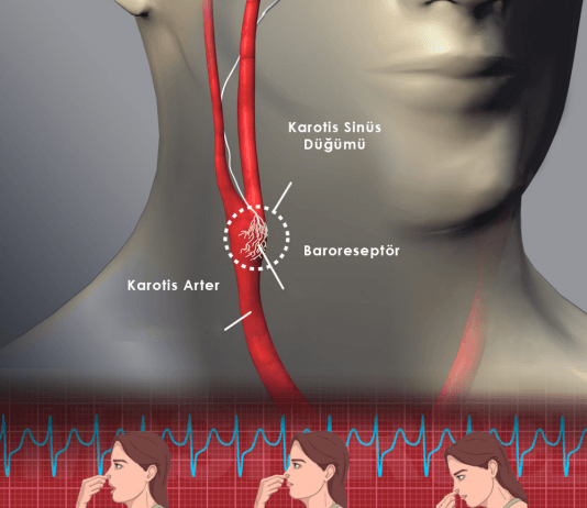 Valsalva Manevrası (Vagal Manevra)