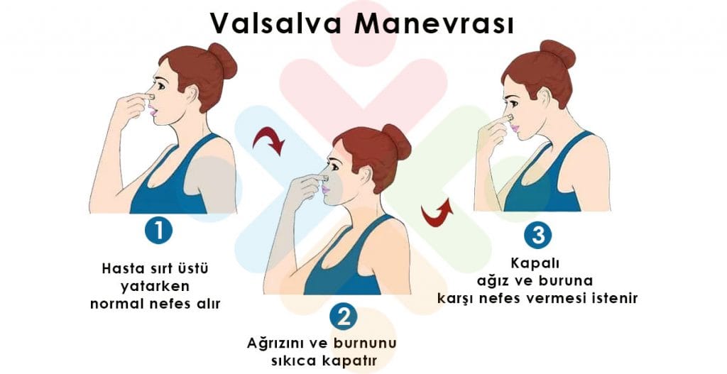 Valsalva Manevrası (Vagal Manevra) Acil Çalışanları