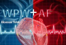 Wolf Parkinson White (WPW) Sendromunda Atriyal Fibrilasyon