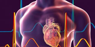 Sol Ventrikül Anevrizması