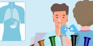 Nazogastrik Sonda (Tüp) Uygulaması