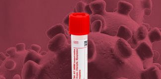 Corona (Korona) Virüs Numune Alımı (Swab) – Saklanması – Nakli