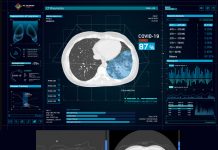 COVID-19 Radyolojik Görüntüleme