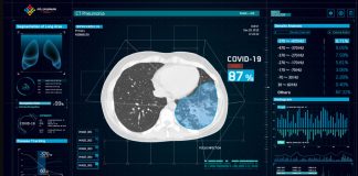 COVID-19 Radyolojik Görüntüleme