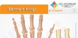 Bennett Kırığı Akıl Kartı