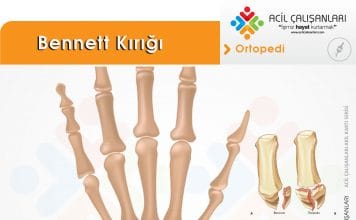 Bennett Kırığı Akıl Kartı