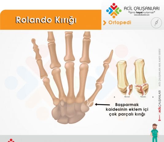 Rolando Kırığı Akıl Kartı