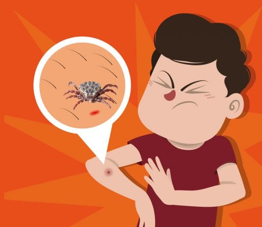 Kırım Kongo Kanamalı Ateşi (KKKA) 45 Yaş Olgu