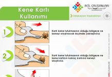 Kene Kartı Kullanımı Akıl Kartı
