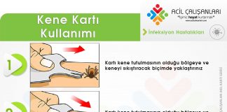 Kene Kartı Kullanımı Akıl Kartı