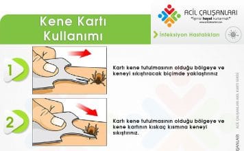 Kene Kartı Kullanımı Akıl Kartı