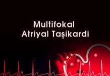 Multifokal Atriyal Taşikardi (MAT)