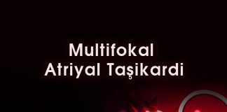 Multifokal Atriyal Taşikardi (MAT)
