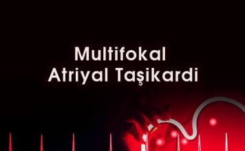 Multifokal Atriyal Taşikardi (MAT)