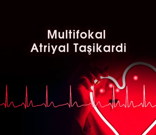 Multifokal Atriyal Taşikardi (MAT)