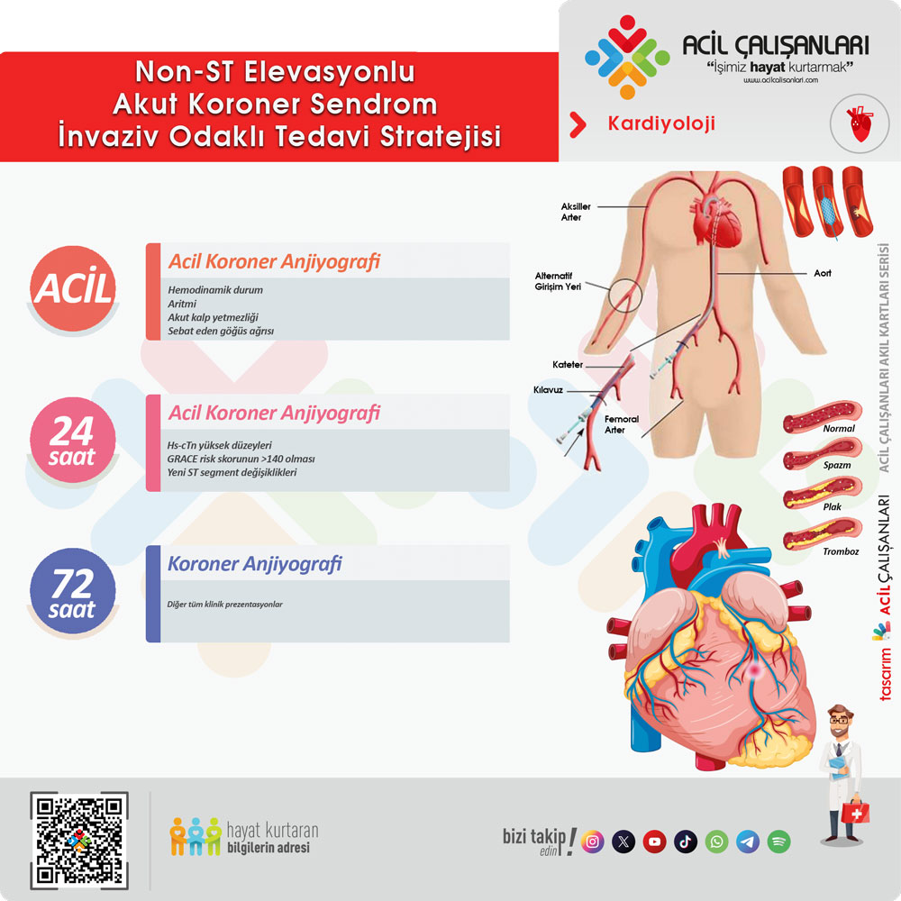 NSTEMI İnvaziv Strateji