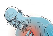 STEMİ Trombolitik Uygulaması 55 Yaş Olgu Sunumu