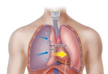 Tansiyon Pnömotoraks Acil Yaklaşım