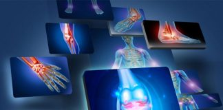 Ekstremite Travmalı Hastaya Genel Yaklaşım