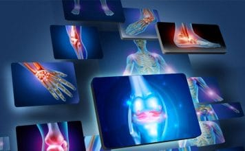 Ekstremite Travmalı Hastaya Genel Yaklaşım