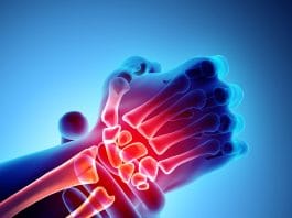 El Travmasına Genel Yaklaşım