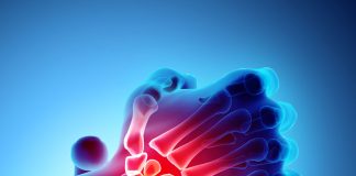 El Travmasına Genel Yaklaşım