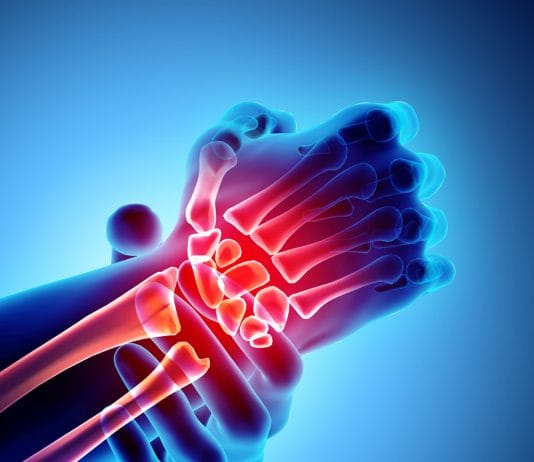 El Travmasına Genel Yaklaşım