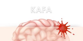 Kafa Travmasına Hastasına Genel Yaklaşım