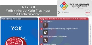 Nexus II Beyin BT Kuralları Akıl Kartı