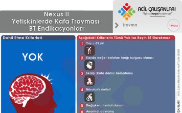 Nexus II Beyin BT Kuralları